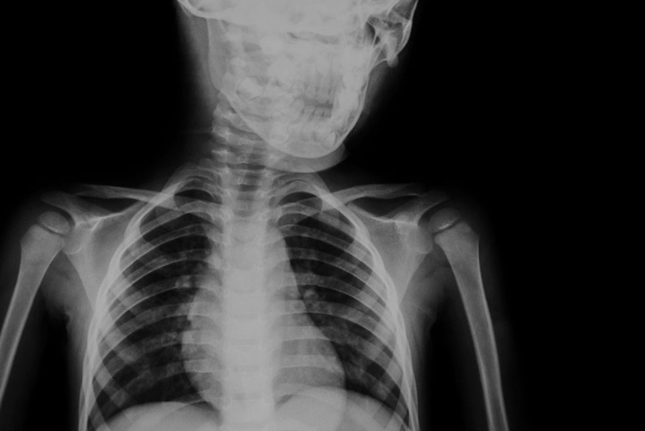 x ray near me bulk bill Marin Rinaldi x ray near me bulk bill Marin Rinaldi