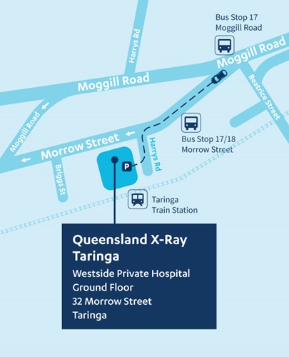 Map of Queensland X-Ray Taringa