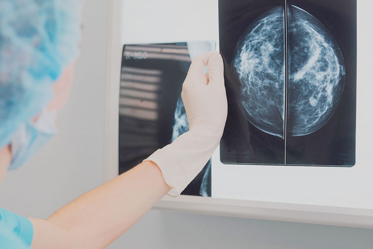 3-D Breast Imaging is Here  The Center for Cosmetic Surgery