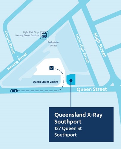 Map of Queensland X-Ray Southport